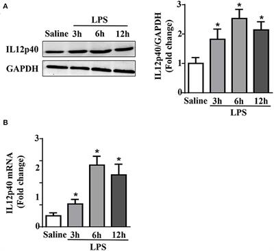 IL-12p40 deletion aggravates lipopolysaccharide-induced cardiac dysfunction in mice
